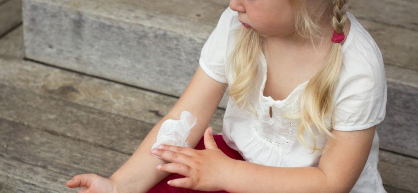 best eczema cream for kids